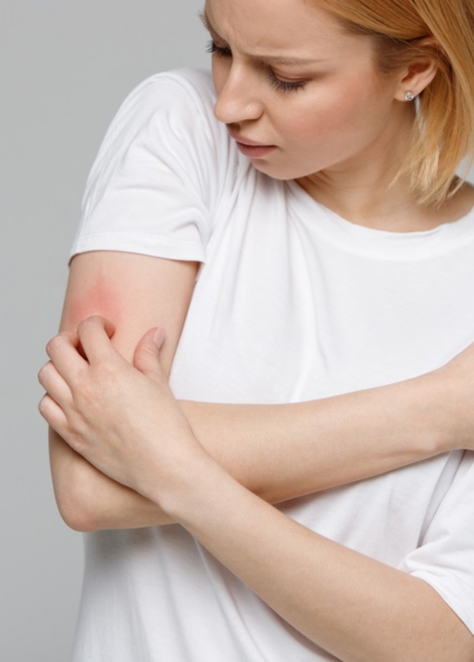 الطفح الجلدي احد ابرز اعراض فيروس كورونا