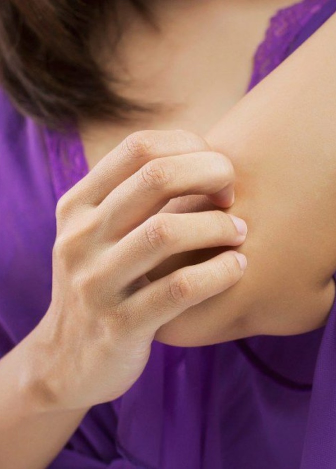  دراسة تؤكد أن البعوض لا ينقل فيروس كورونا