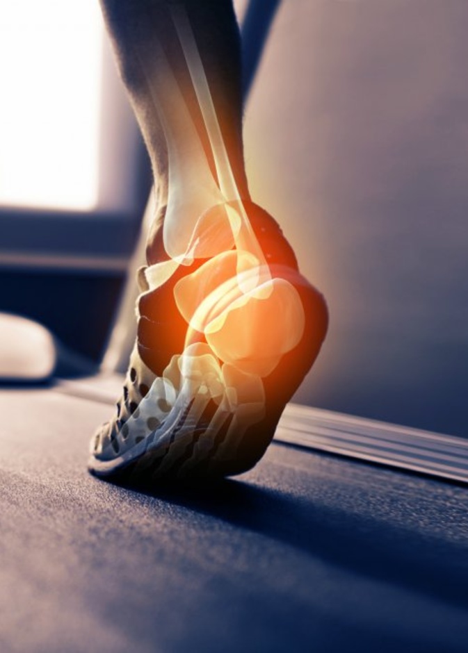 أسباب ألم كعب القدم عند النساء