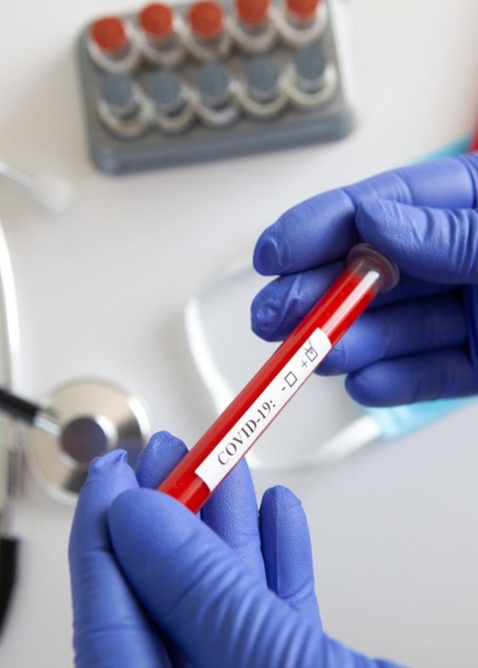 مؤشرات حيوية تكشف خطر الوفاة نتيجة الاصابة بكورونا