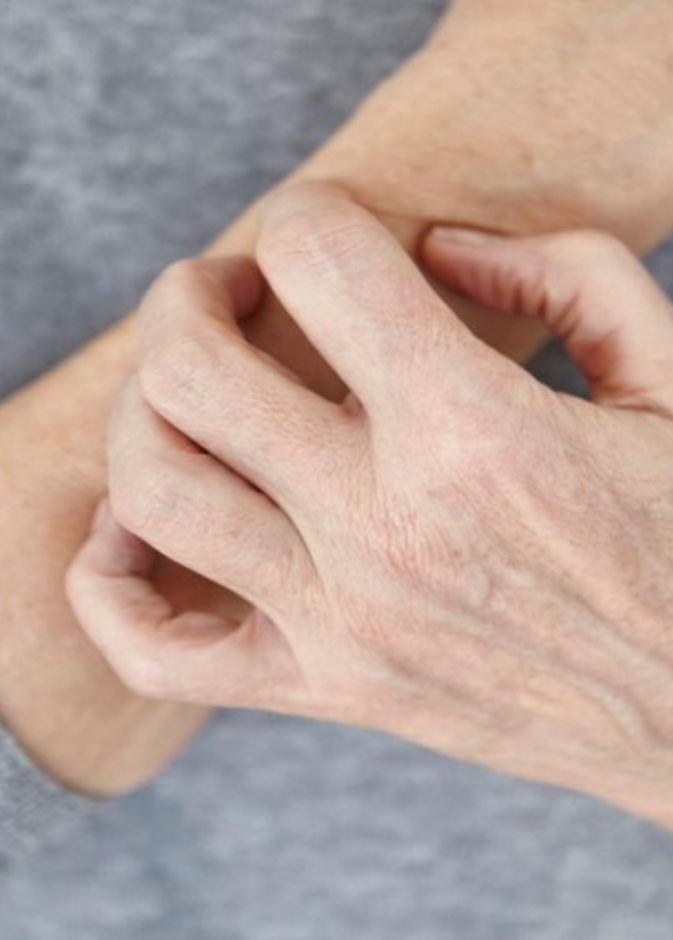 الحكة وإحمرار الجلد من أبرز أعراض الأكزيما الجلدية