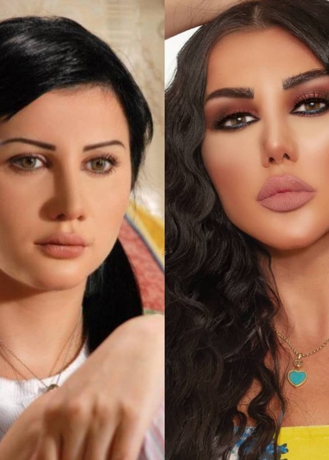 صور جيني اسبر قبل وبعد عمليات التجميل