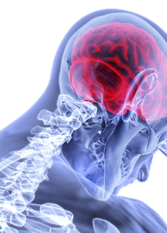 عدم ممارسة النشاط البدني يزيد من فرص تعرضك للسكتات الدماغية