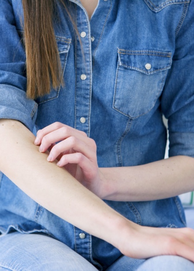 التهاب الجلد العصبي من الامراض الجلدية الشائعة