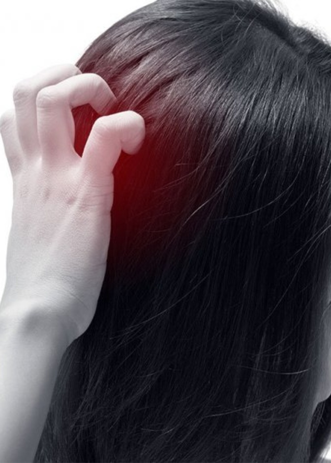  اعراض الاكزيما الدهنية في فروة الرأس واهم اسبابها وطرق علاجها