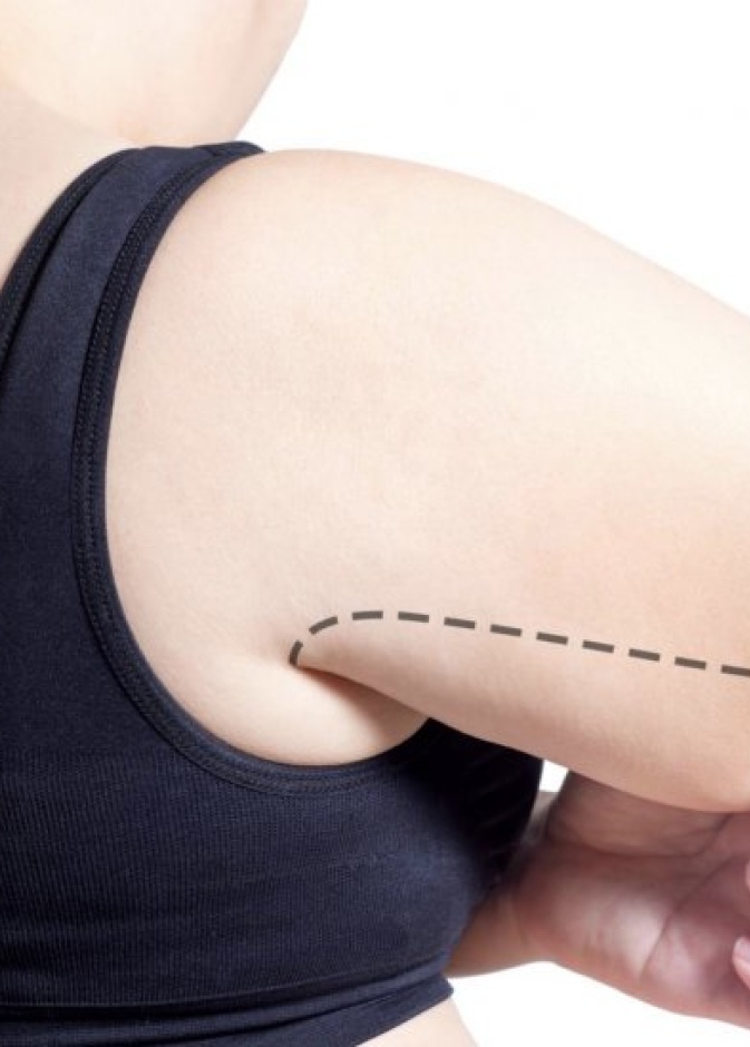  أهم مضاعفات عملية شد الذراعين والآثار الجانبية