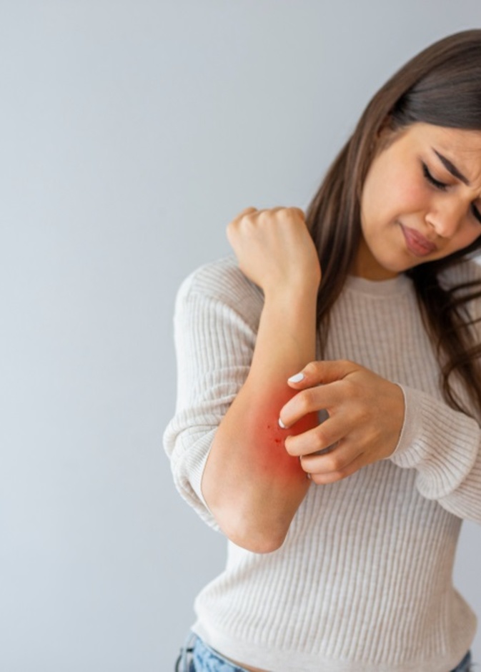 ما هي الاكزيما العصبية واهم اسبابها وطرق علاجها