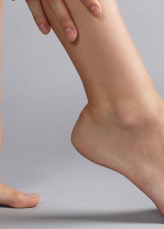 مخاطر علاج دوالي الساقين بالليزر قليلة وتمنحك نتائج رائعه