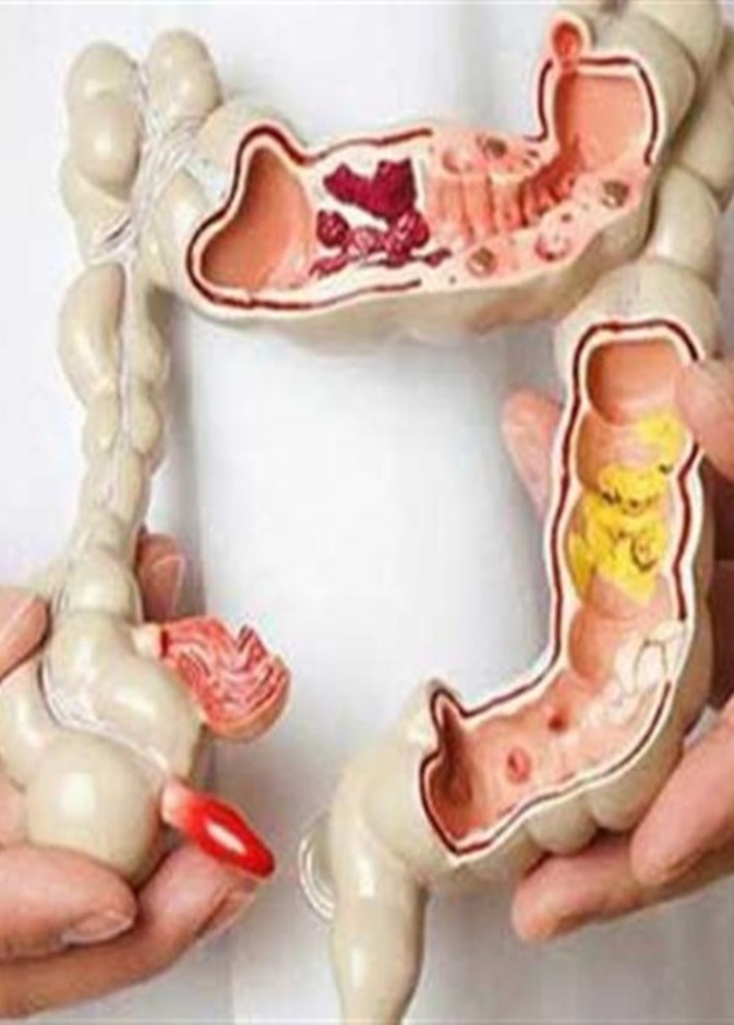  أهمية تنظيف القولون ومخاطره