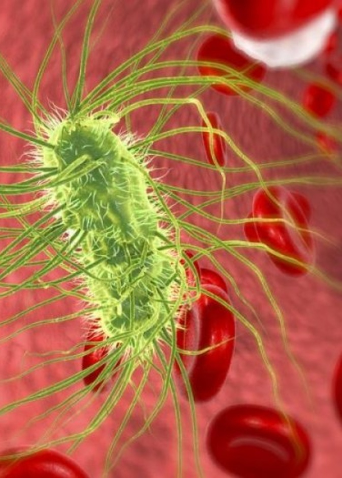 القيام بالحفاظ على نظافة وغسيل اليدين بشكل منتظم تضمن سلامتك من تسمم الدم الجرثومي