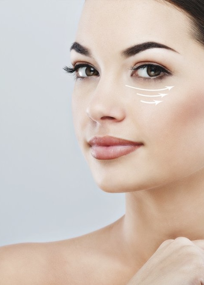 كيفية الوقاية من الهالات السوداء تحت العين