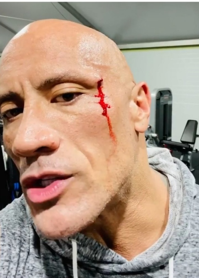 ذا روك يتعرض للاصابة في وجهه