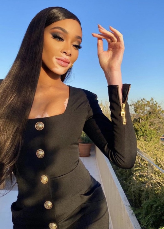 ويني هارلو تستمتع بأجواء الخريف الصباحية بإطلالتها الأنيقة