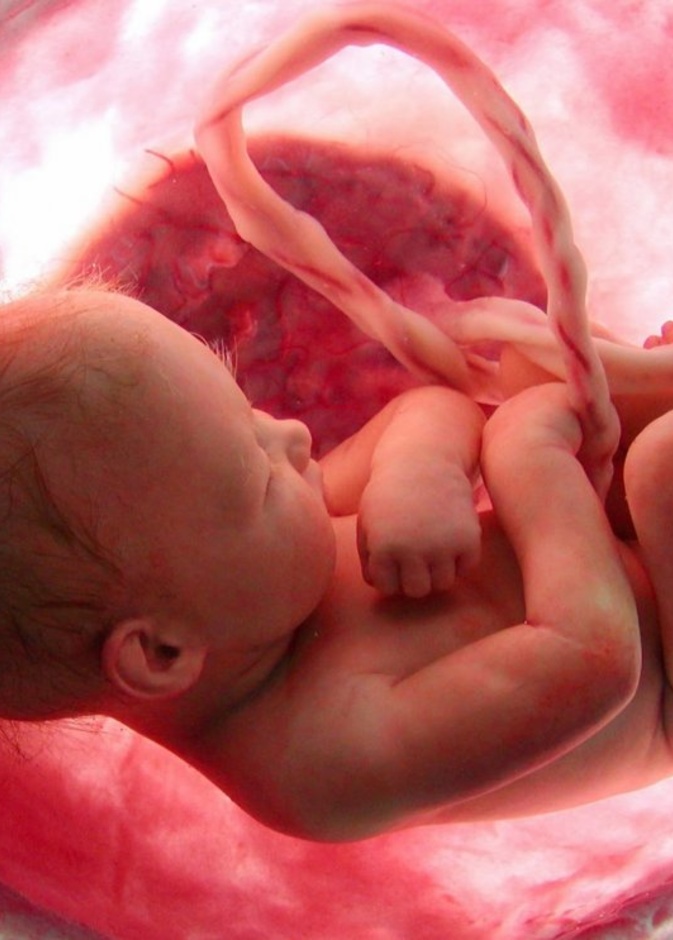 أسباب وأعراض موت الجنين في رحم الأم