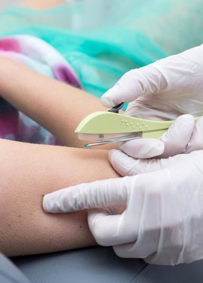 هل شريحة منع الحمل تسبب نزيف