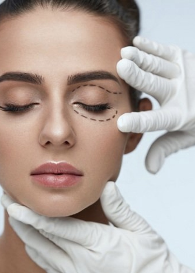 عملية شد الجفون تعالج تدلي الجفون وتنقي مجال الرؤية