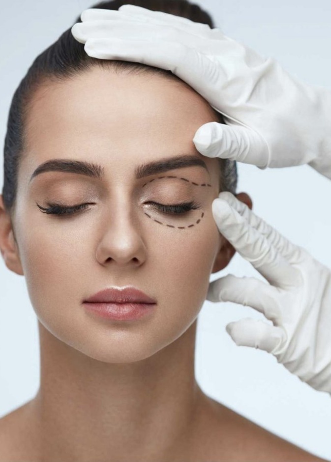 علاج الهالات السوداء حول العينين من خلال عملية شد الجفون