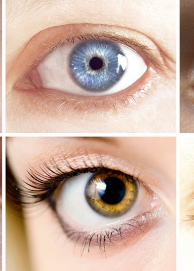  لون العيون وعلاقته بالأمراض