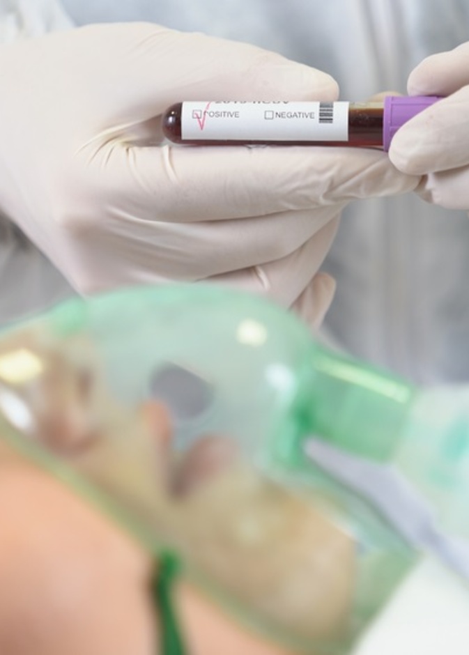  لماذا يحتاج بعض مرضى فيروس كورونا الجديد الى جهاز التنفس الصناعي