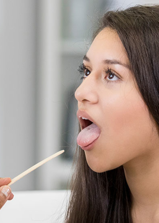  ماهي اسباب تغير اللسان الى الاصفر ومضاعفات ذلك