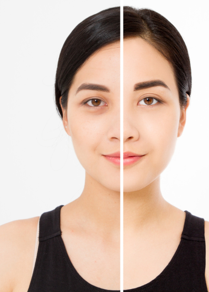 "الهالات السوداء"  تتحول  لصيحة جمالية رائجة