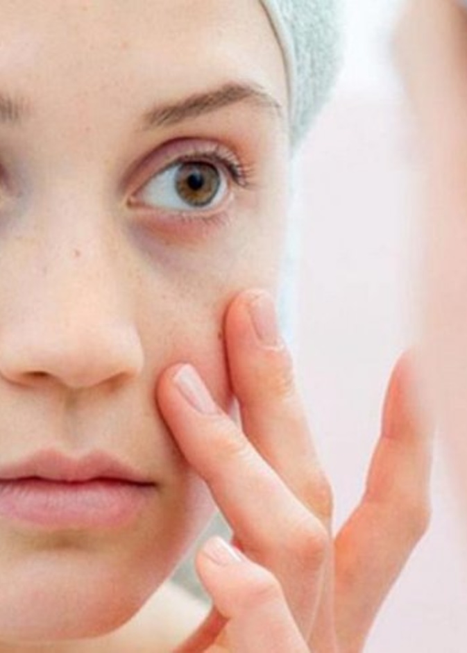 لاتصدقوا هذه الأمور عن الذئبة الحمراء