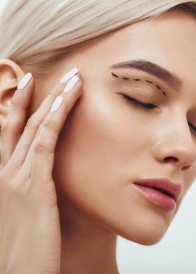 جراحة الجفن، لتحسين مظهر أو وظيفة الجفون