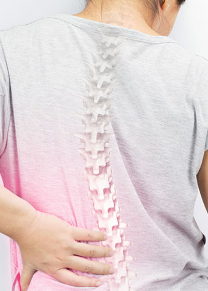 ماهي اعراض انحراف العمود الفقري وماهي الاسباب والمضاعفات