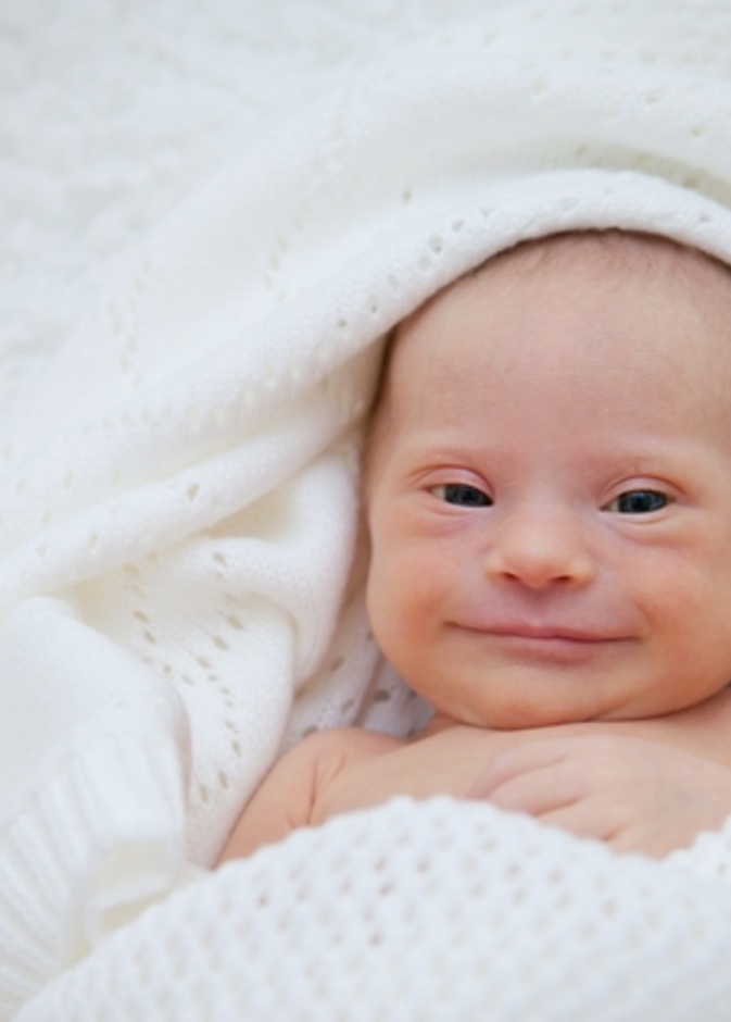 9 أعراض تدل على إصابة الطفل حديث الولادة بمتلازمة داون