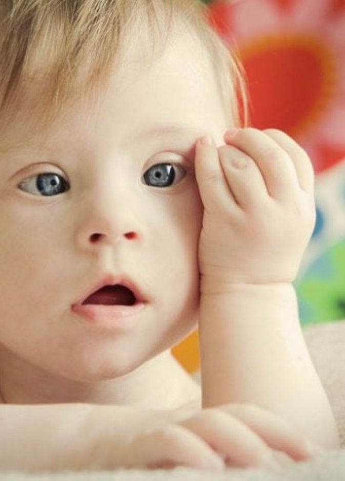 صعوبات التعامل مع طفل متلازمة داون