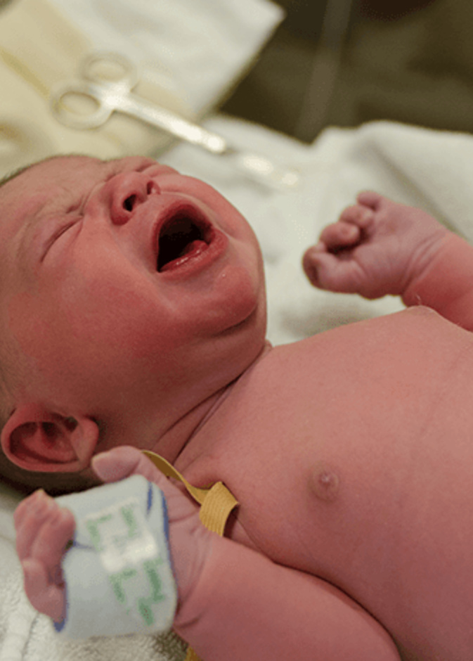 ما هي أسباب عدم بكاء الطفل بعد الولادة