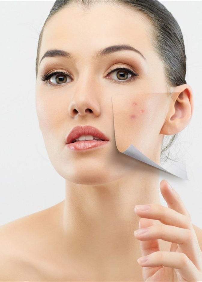 طرق التخلص وعلاج ندبات حب الشباب تجميلياً