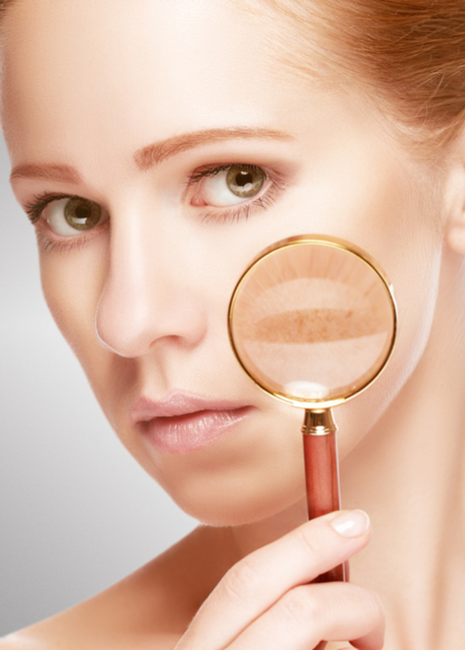 نصائح جمالية عند استخدام طريقة بدة الشيا والزنجبيل للتخلص من الكلف واثاره