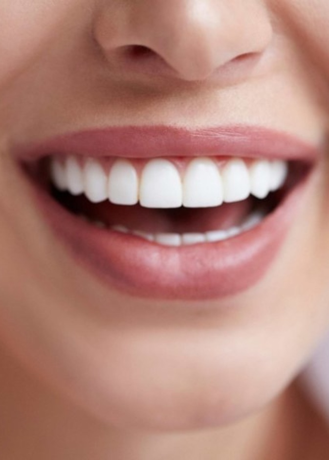 اطعمة تساعد في تبييض الاسنان