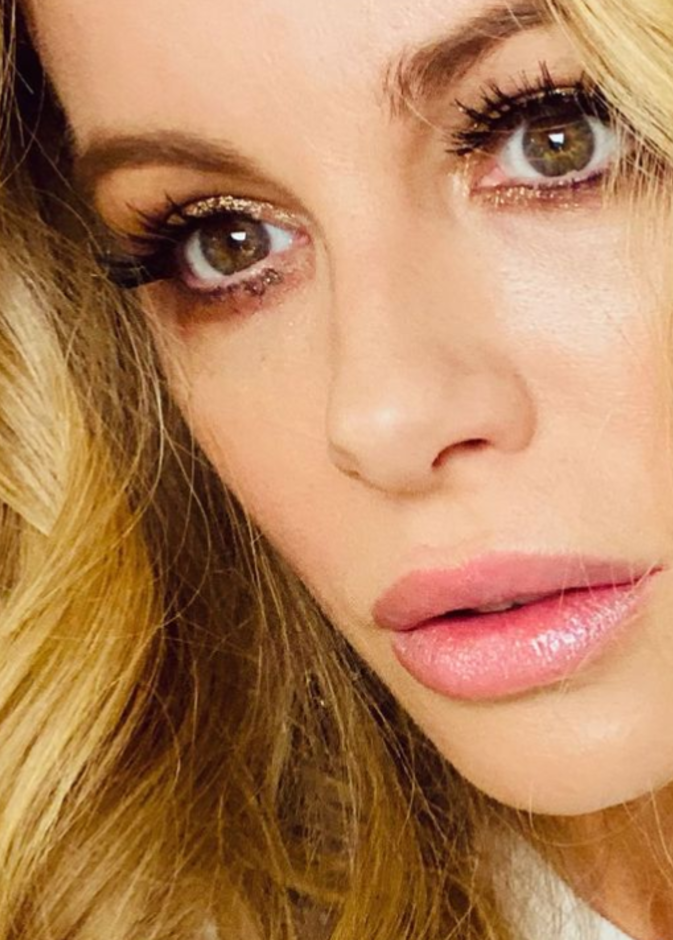 كيت بيكنسيل - الصورة من حساب كيت بيكنسيل على انستجرام