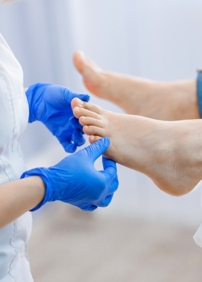  10 نصائح لمرضى السكري للتعامل مع القدم السكرية