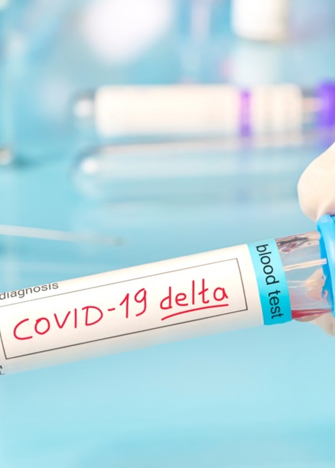 هل يصبح فيروس كورونا اكثر عدوى مع انتشار متحور دلتا