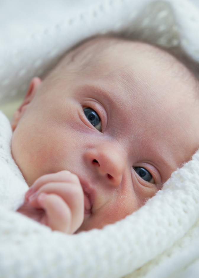  كيف يظهر شكل الطفل المنغولي في السونار