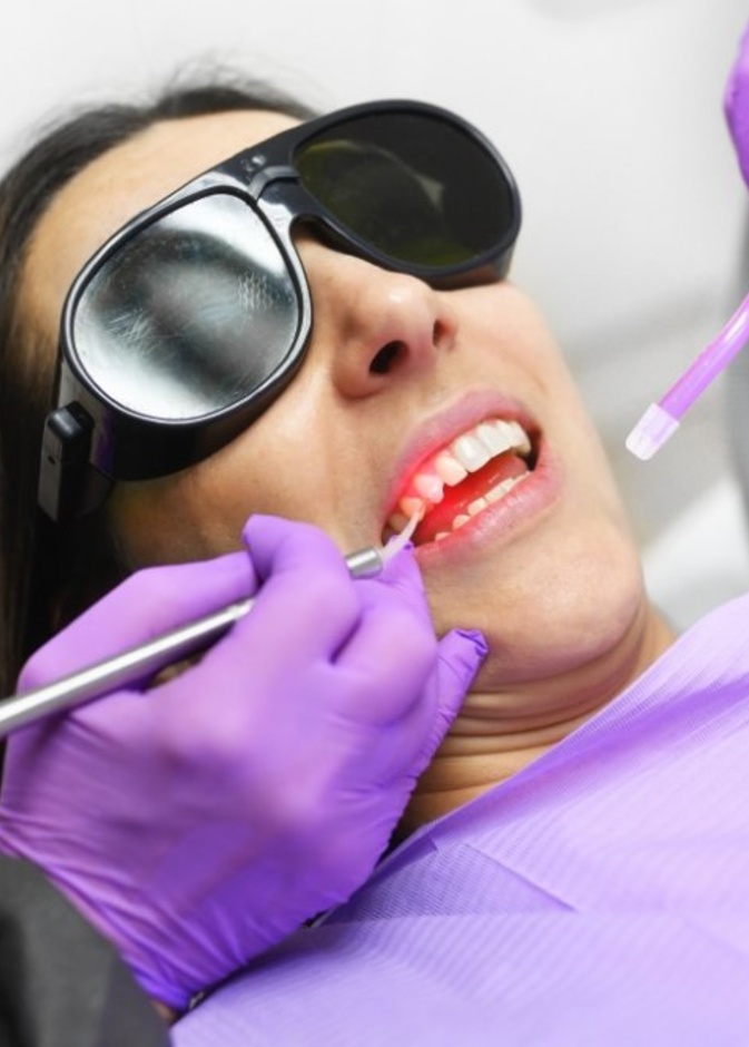 ما هي عملية تجميل اللثة بالليزر وأهم أضرارها