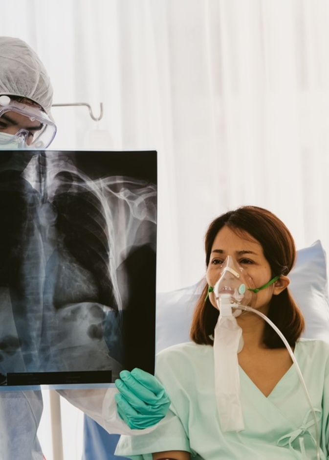 متى يكون جهاز التنفس الصناعي ضروري لمريض كوفيد 19