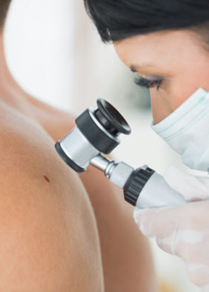 فحص الشامات ضروريٌ لأن بعضها قد يكون سرطانياً