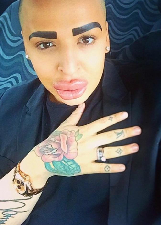 حاول أن ييشبه بكيم كارداشيان فانتهى به الأمر كأمبر روز!