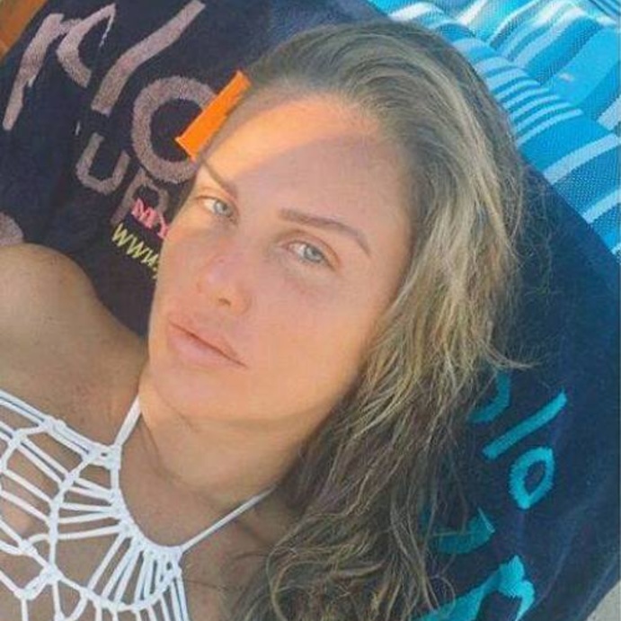 نمش نيكول سابا "عيوب جمالية"