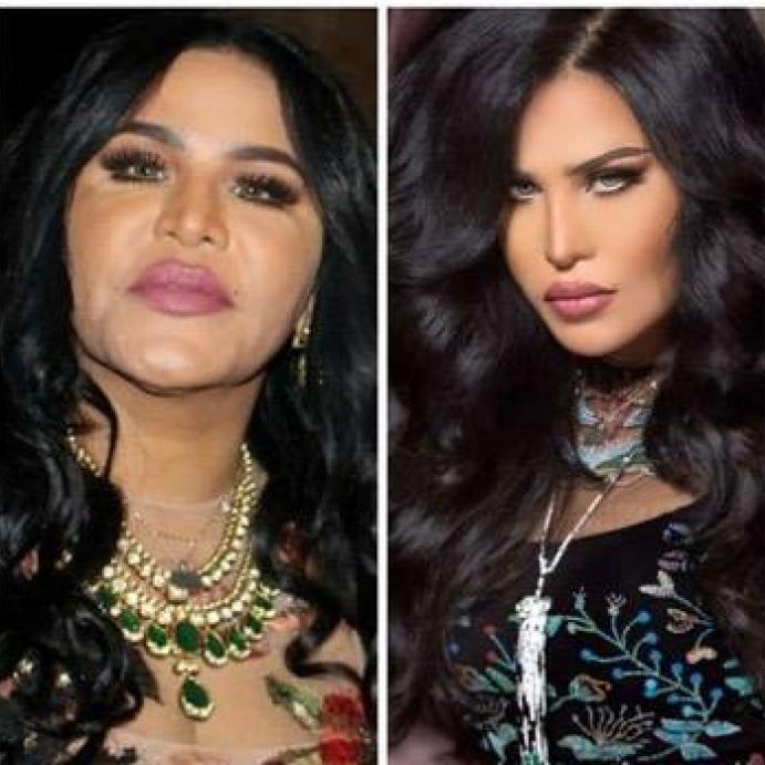 أحلام قبل وبعد الفوتوشوب