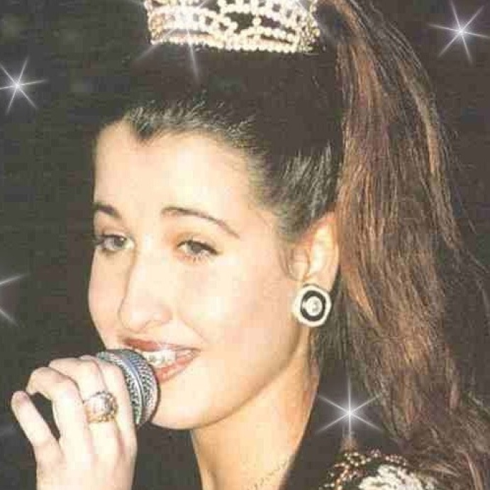 عمليات تجميل الفنانات