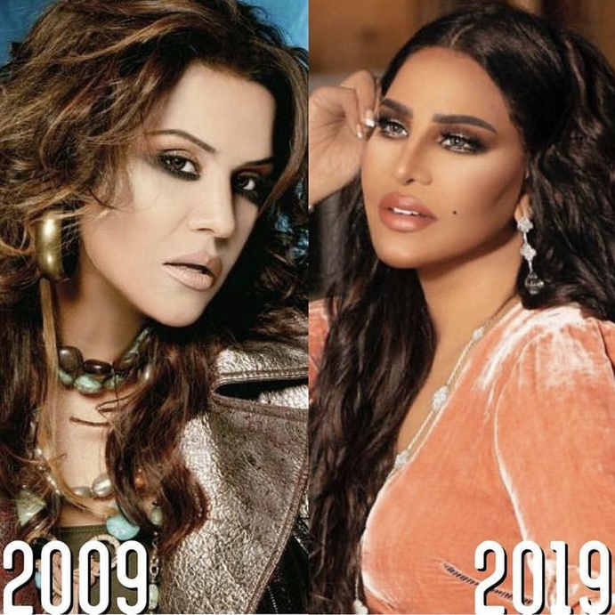 الفنانة أحلام 