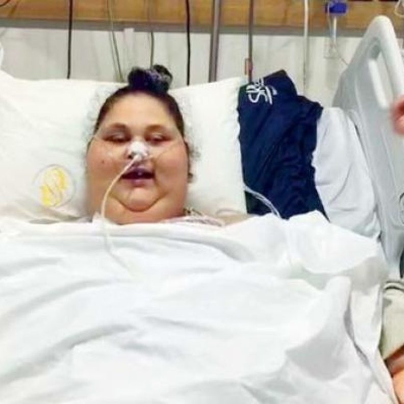 إصابة أسمن فتاة في العالم بالشلل واتهامات للطبيب الهندي بالتقصير