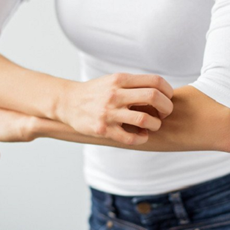 الحكة أبرز أعراض مرض الصدفية