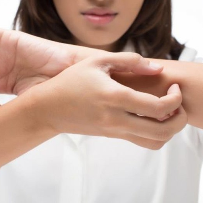  الحكة من أعراض الطفح الجلدي.