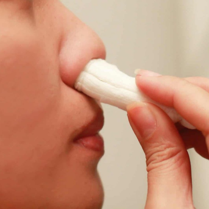 وضع الشاش بطريقة معينة لوقف نزيف الانف